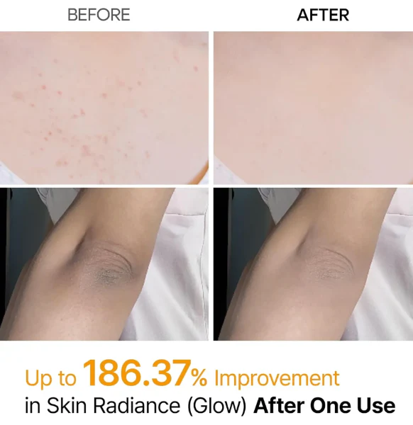 DR.MELAXIN Kojic Acid Spray200ml , 닥터멜락신 필샷 케라틴 케어 강황 스프레이 200ml , - Image 4