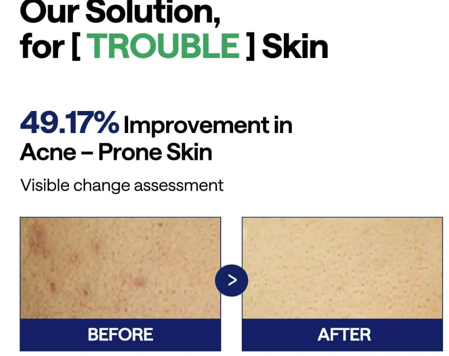Mediheal Teatree Trouble Pad , 메디힐 NO.1 티트리 패드 , EA - Image 3